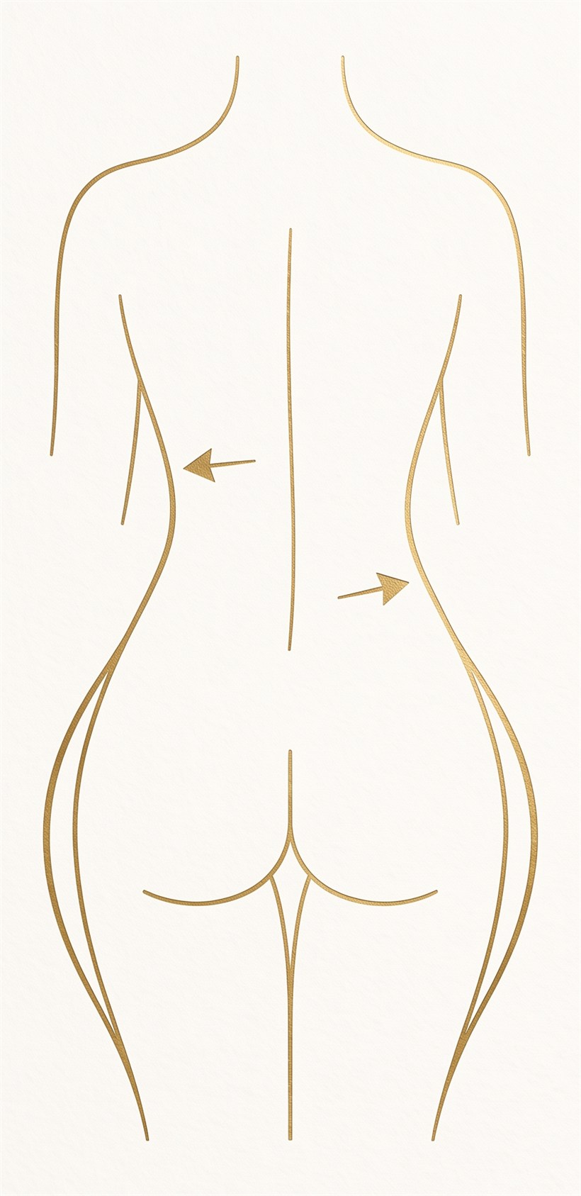 Rear silhouette showing 360 contouring: fat sculpted from the waist to form an hourglass