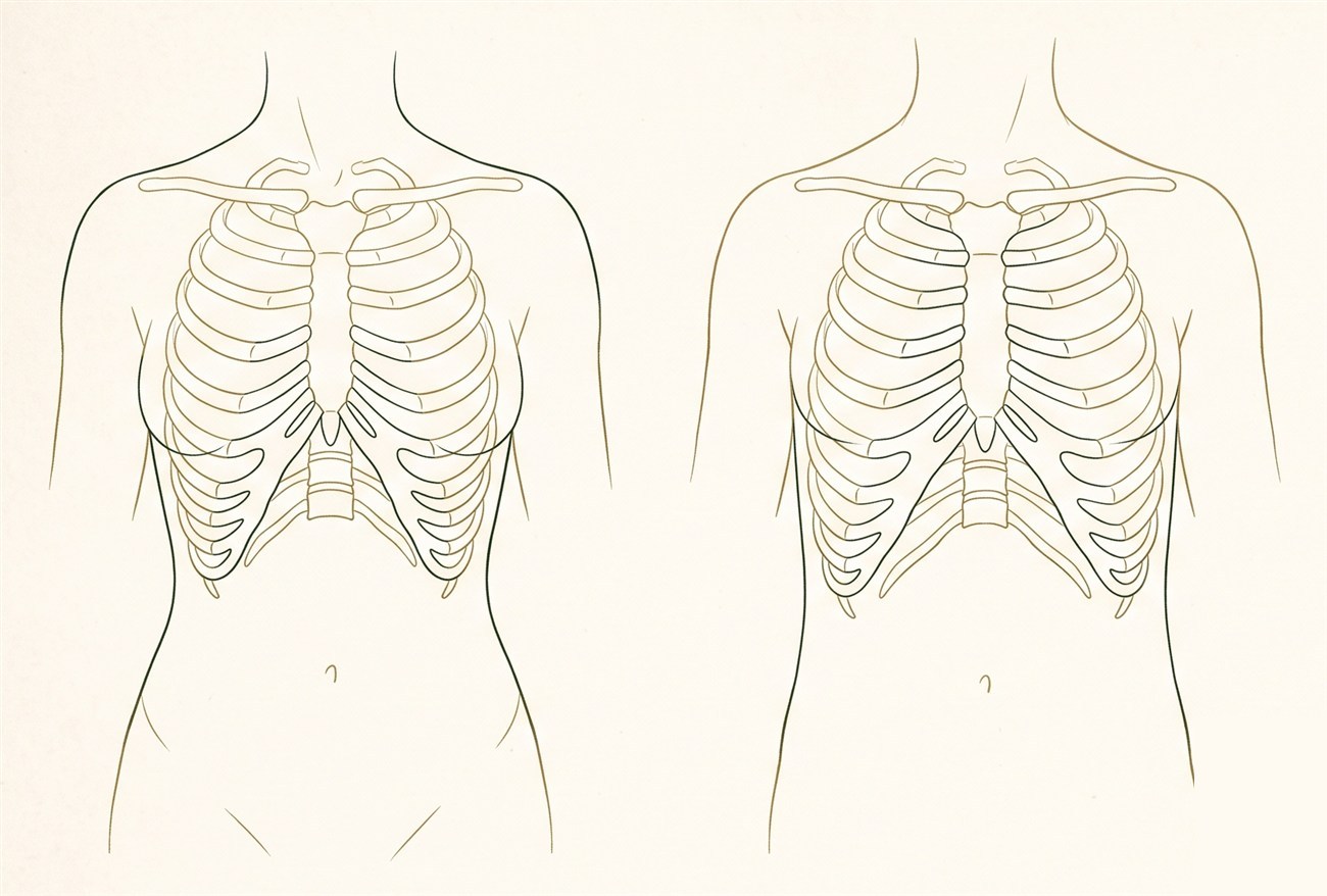 Diagram: a narrow lower rib cage with a defined waist versus a wider, opened rib cage after pregnancy or weight gain